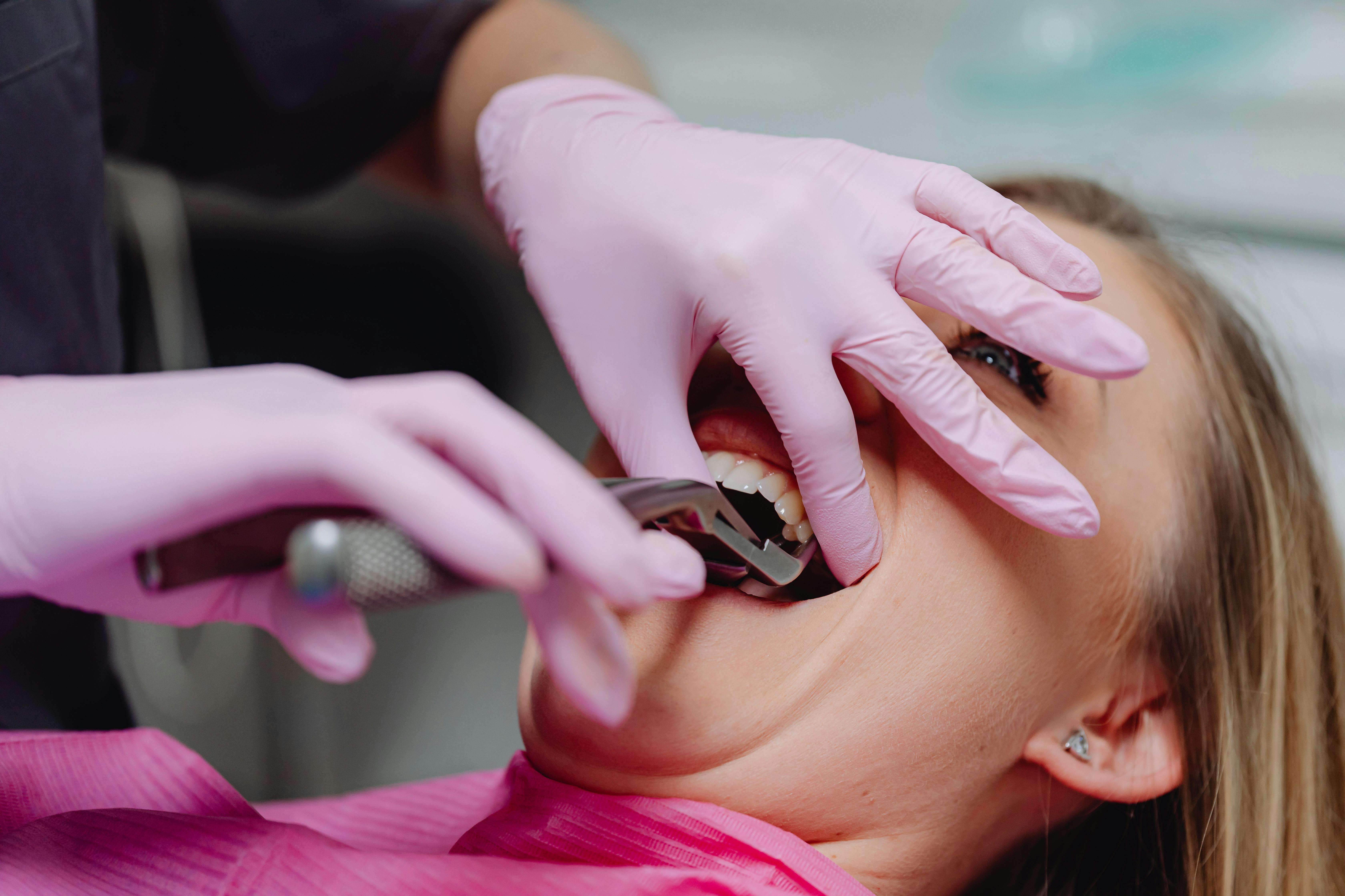 Why Wisdom Teeth Don’t Always Need Removal