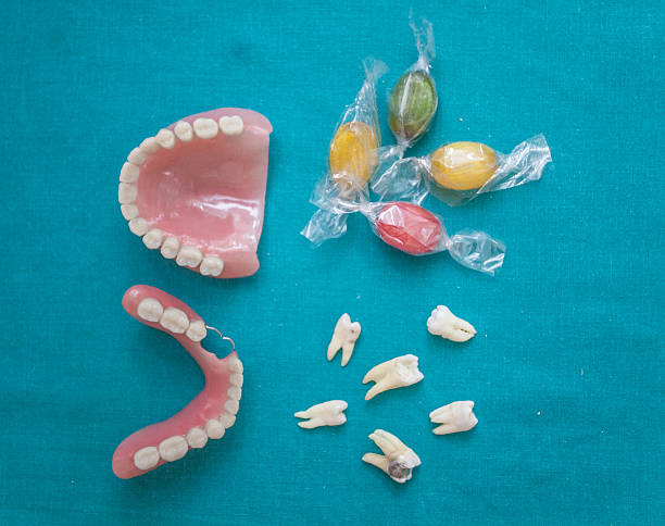 What to Eat Before & After Wisdom Tooth Surgery