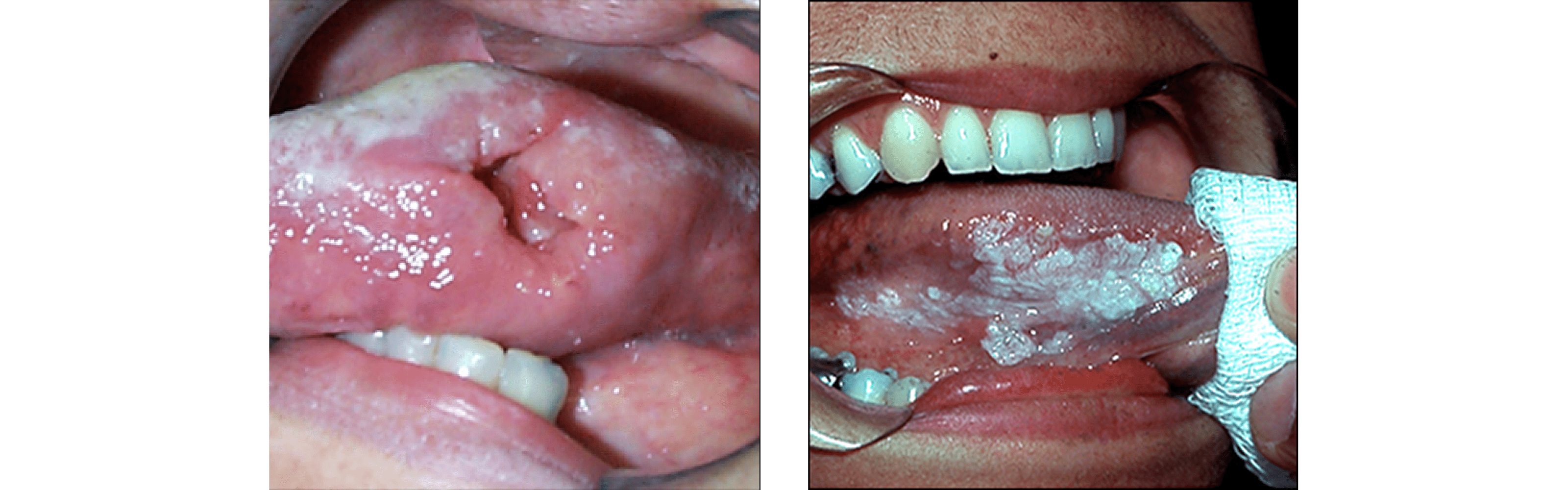 Oral Pathology