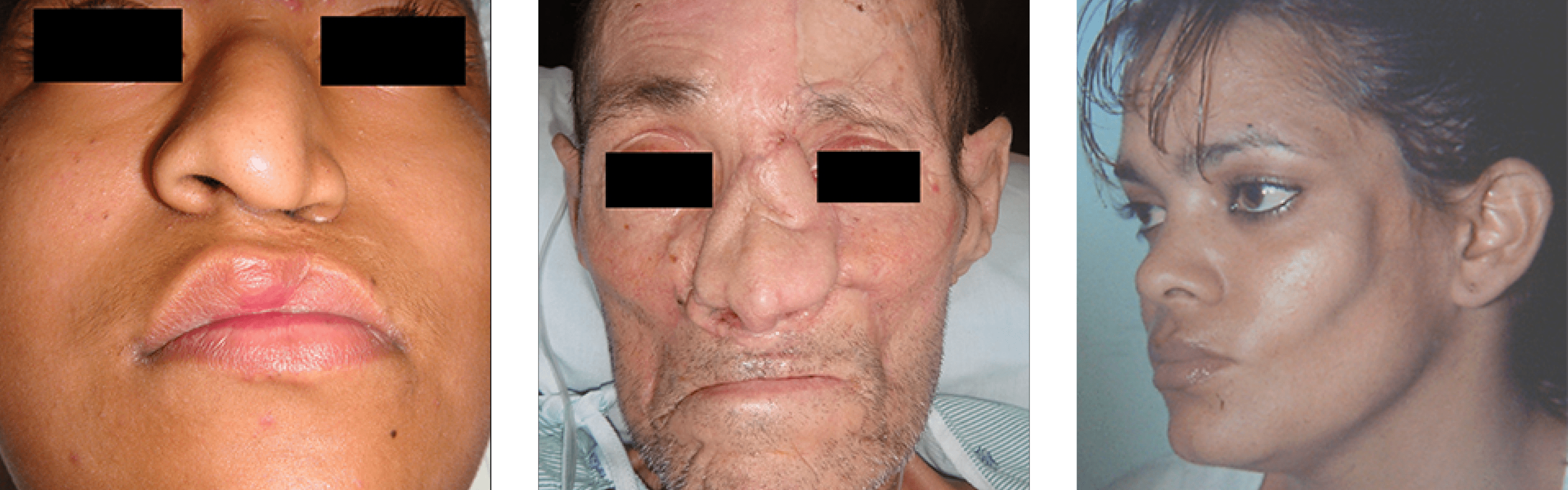 Reconstructive Facial Surgery