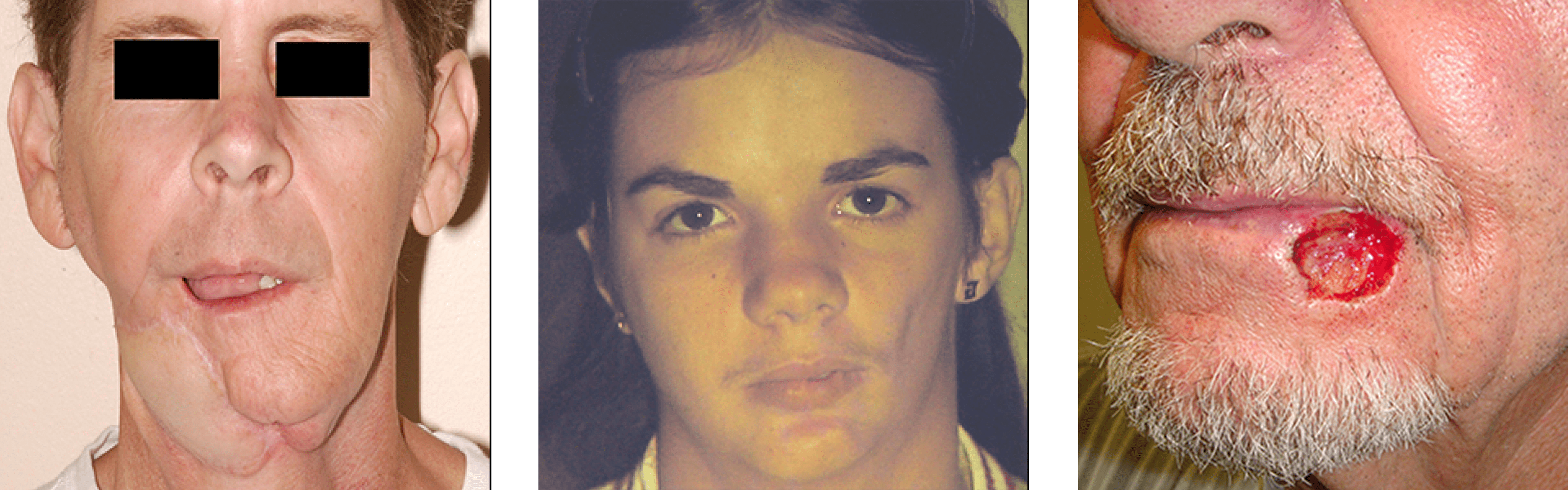 Reconstructive Facial Surgery