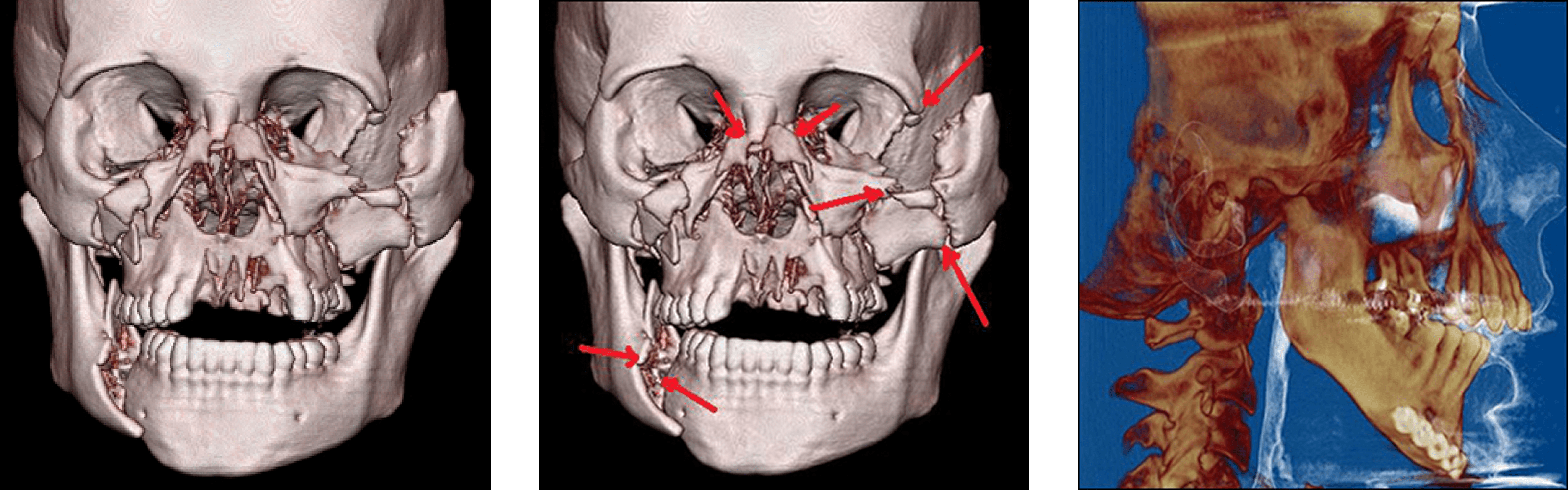 Facial Feature